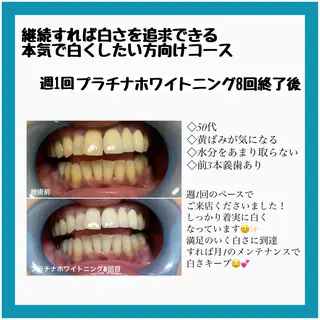 ネイル/耳つぼ /新ホワイトニングのネイルデザイン