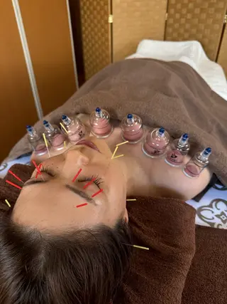 美容鍼・脱毛サロン Callaのエステ・リラクイメージ