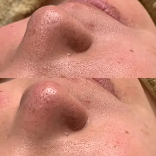 muuu.所属・石野 眞生のエステ・リラクイメージ