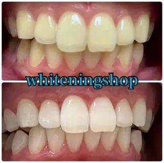 ホワイトニング ショップ吉祥寺店のエステ・リラクイメージ