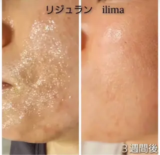 ilima NARUMIのエステ・リラクイメージ