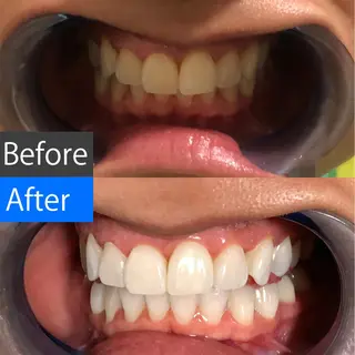 カラー キッズ ショート パーマ ネイル ヘアアレンジ マツエク・マツパ メンズ アイブロウ 中目黒 ホワイトニングサロンのその他イメージ