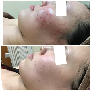 エステティックレイ ビス秋田店　菅野のエステ・リラクイメージ