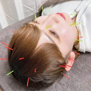 美容鍼・小顔矯正 ハリシェンドのエステ・リラクイメージ