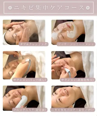 Beauty salon ~Ohana~所属・【ニキビ肌改善】 肌質改善Ohanaのエステ・リラクイメージ