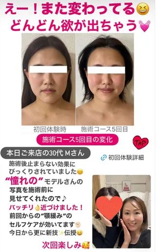 la lumie're (ラ リュミエール)所属・小顔サロン (ラ リュミエール)のエステ・リラクイメージ