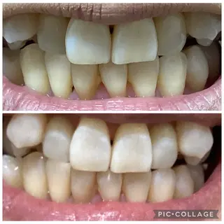 セルフホワイトニングサロン　Betee所属・セルフホワイトニング Beteeのエステ・リラクイメージ