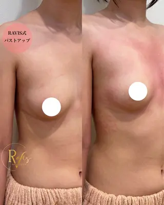 beautysalon RAVIS所属・東大阪/韓国肌管理/ 痩身バスト専門店のエステ・リラクイメージ