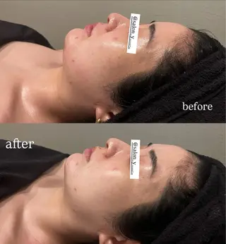 コルギ✖︎ピーリング y ANESISのエステ・リラクイメージ