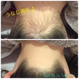 美肌脱毛・ハーブピーリング専門店Larin la beaute所属・Larin la beauteのエステ・リラクイメージ