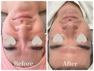 産後/ツヤ肌/子連れ /保育士在籍サロンのエステ・リラクイメージ