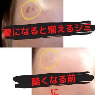 メンズ 男女同額脱毛エステ salonLEPIAのエステ・リラクイメージ