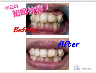 セルフホワイトニングサロン　ラヴィアン所属・ホワイトニングサロン La vie enのその他イメージ