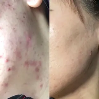 小顔×痩身専門サロンCLORE浦和店所属・石川 彩花のエステ・リラクイメージ