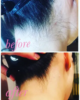 B.glad所属・ブラジリアンワックス 全身脱毛B.gladのエステ・リラクイメージ