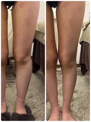 深部加温に特化した ブレッシングのその他イメージ