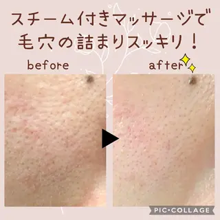 ナリス化粧品　出雲デアイム所属・フェイシャルエステ⭐ 佐藤友紀のエステ・リラクイメージ