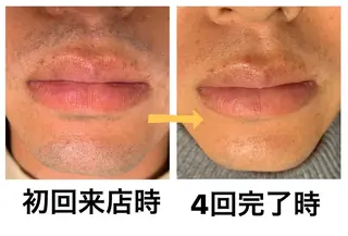 メンズ脱毛サロン Le falcoのエステ・リラクイメージ