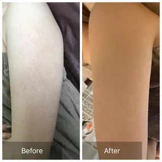 ハーブピーリング 専門店MOKA所属・ハーブピーリング専門 MOKAのエステ・リラクイメージ