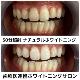 Platinum Beauty 四条烏丸店所属・吉田亮利 ホワイトニング専門店のその他イメージ