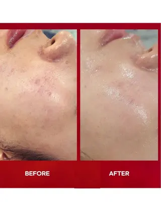 脱毛.エステ ベリンダのその他イメージ