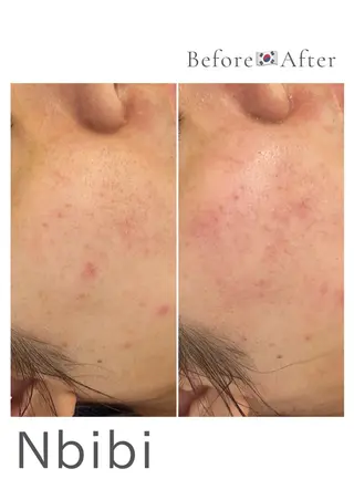 韓国🇰🇷価格 サロン_Nbibiのエステ・リラクイメージ