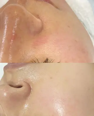 ショート aliaハイフ&水光ジェットサロン所属・aliaハーブ水光店 エステティシャン募集のエステ・リラクイメージ