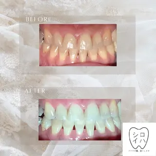 ホワイトニングサロン シロイハ所属・歯を白くしたい方🦷 シロイハのその他イメージ
