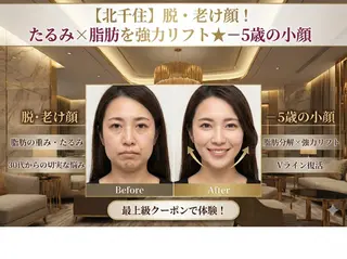 【歴13年】劇的小顔 D rマジックタッチのエステ・リラクイメージ