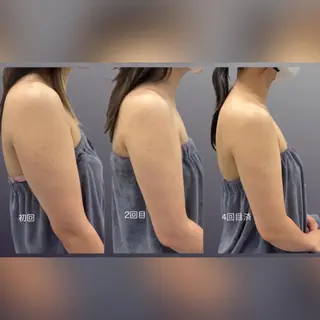 心斎橋🤍堀江.小顔 ハーブ.痩身クレビアのエステ・リラクイメージ