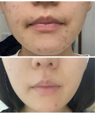 Le Cherien所属・姫路/肌管理/脱毛 Le Cherienのその他イメージ