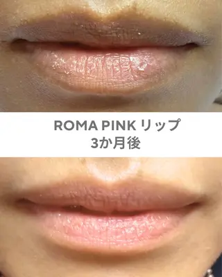 GrandAzure 大人の肌改善のエステ・リラクイメージ