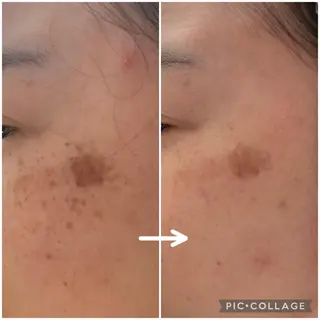 シミケア E Lashのエステ・リラクイメージ