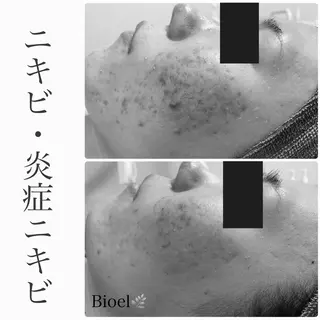 BeSkin藤沢店所属・ニキビ/肌質改善 BeSkin 藤沢店のエステ・リラクイメージ