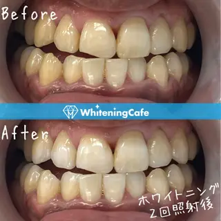 ホワイトニングカフェ徳島沖浜店所属・ホワイトニングカフェ 徳島沖浜店のエステ・リラクイメージ