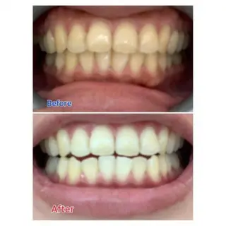 M渋谷店所属・Ｍ渋谷 ホワイトニングのエステ・リラクイメージ