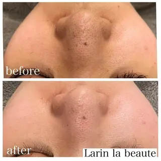 美肌脱毛・ハーブピーリング専門店Larin la beaute所属・Larin la beauteのエステ・リラクイメージ
