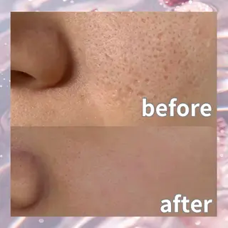 パーマ 愛維美水光美肌専門店所属・愛維美水光美肌専門店 メンズレディースokのエステ・リラクイメージ