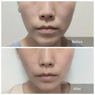 nail RiRi アトレナチュラのエステ・リラクイメージ