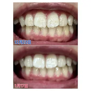 MBEAUTYSALON 千葉店・京成大久保所属・Melty 輝のその他イメージ