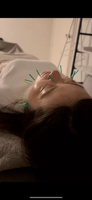 美容鍼×小顔矯正 ×美容整体　浜川泰仁のエステ・リラクイメージ