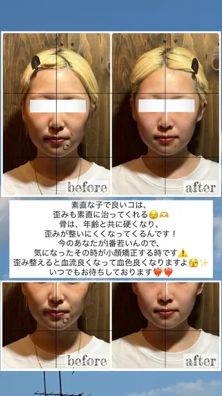 💎後悔させない小顔 矯正💎イトヤマ🌱のエステ・リラクイメージ