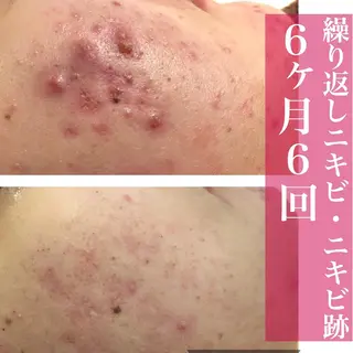 ミディアム カラー パーマ ヘアアレンジ メンズ キッズ ネイル マツエク・マツパ ニキビ・肌質改善専門 ♡人生が変わるサロンのエステ・リラクイメージ