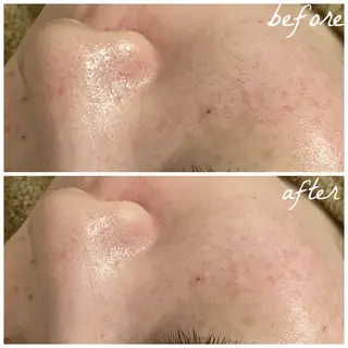 メンズ メナード岐阜茜部 杉浦のエステ・リラクイメージ