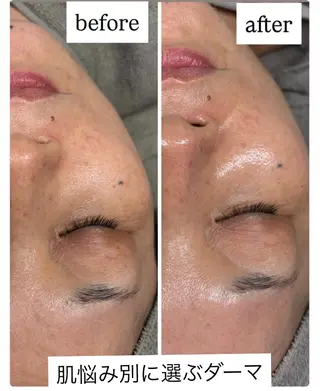 Salon【yuzu.】所属・🍊肌管理×美眉 【yuzu.】の眉毛・アイブロウイメージ