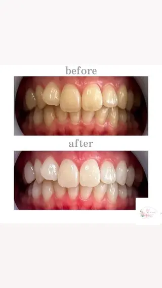 ホワイトニング ショップ本厚木のその他イメージ