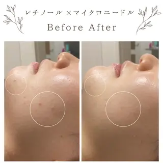 な ぎのエステ・リラクイメージ