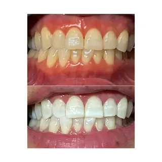 ホワイトニングジム 池袋のその他イメージ