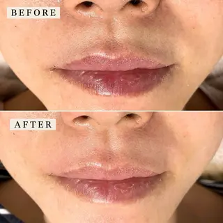 【産毛・眉毛ケア＆肌質改善サロン】＊BiBi＊beautysalon所属・眉･産毛専門BiBi 糸脱毛スレッティングのエステ・リラクイメージ