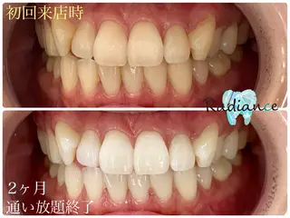 札幌ホワイトニング ラディアンス札幌駅店のその他イメージ